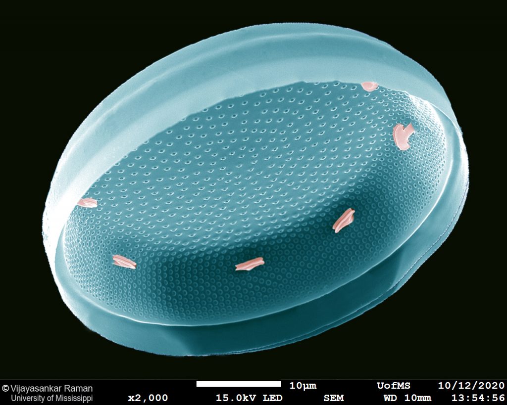 Colorized SEM image of a centric diatom