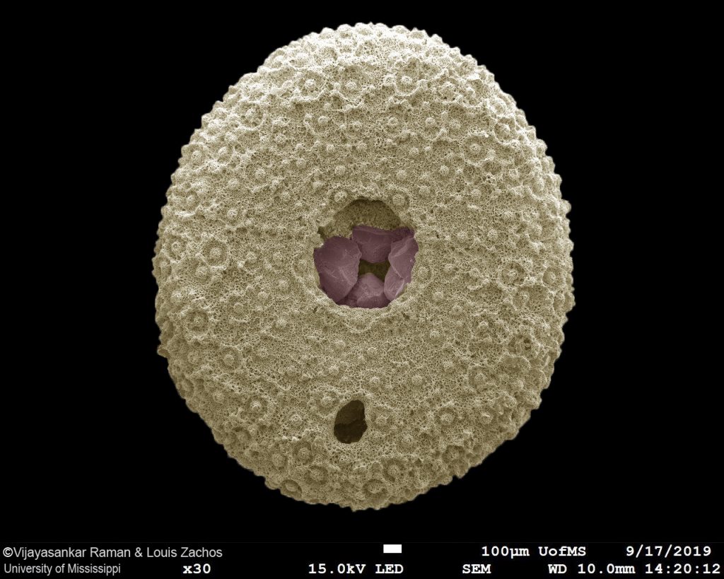 SEM image of a 245 million-year-old echinoid fossil Periarchus lyelli
