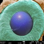 SEM image of a developing eye of a 18 hrs-old zebrafish embryo