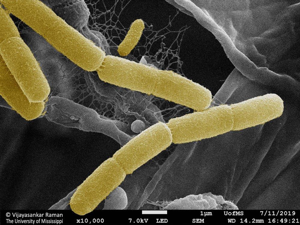 Colorized SEM image of Escherichia coli bacteria
