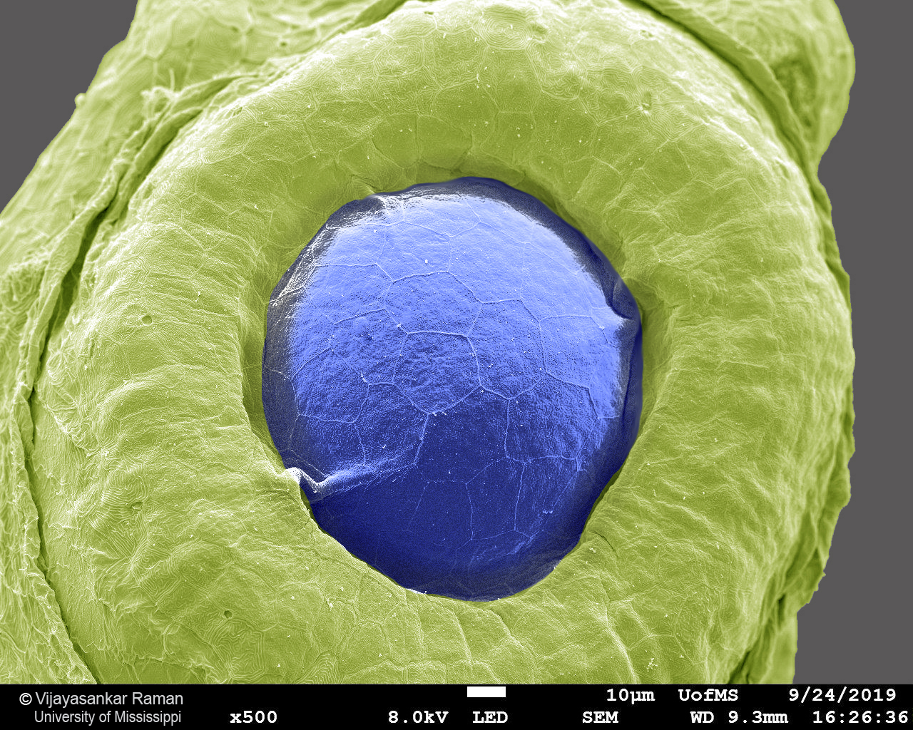Colorized SEM image of a developing eye of a zebrafish embryo