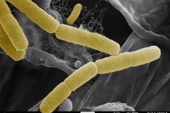 3-Bacteria-found-in-a-Tinospora-sample